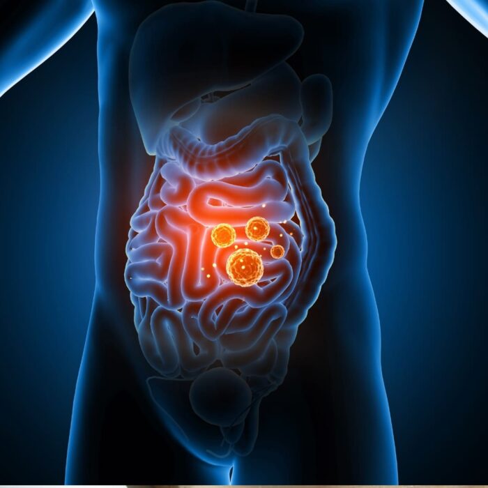 Intestin perméable microbiote