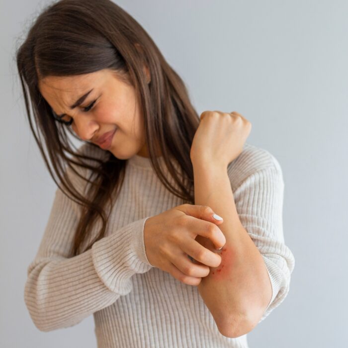 Troubles extra-digestifs