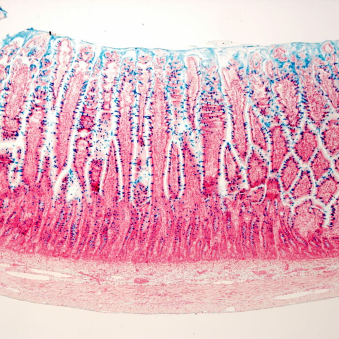 Porosité intestinale villosités